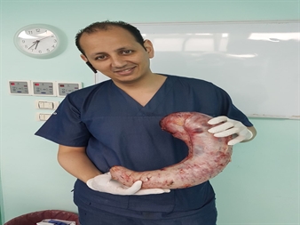 دكتور أحمد المصرى لجراحات السمنة المفرطة 